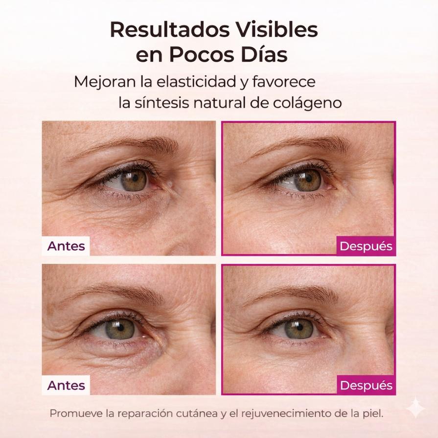 Tu Piel Radiante Sin Agujas Ni Dolor - Bálsamo Antiarrugas Alma