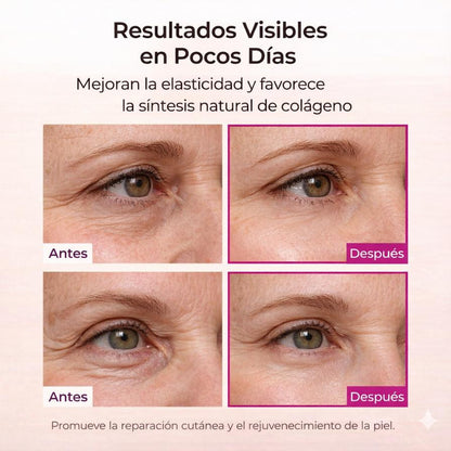 Tu Piel Radiante Sin Agujas Ni Dolor - Bálsamo Antiarrugas Alma